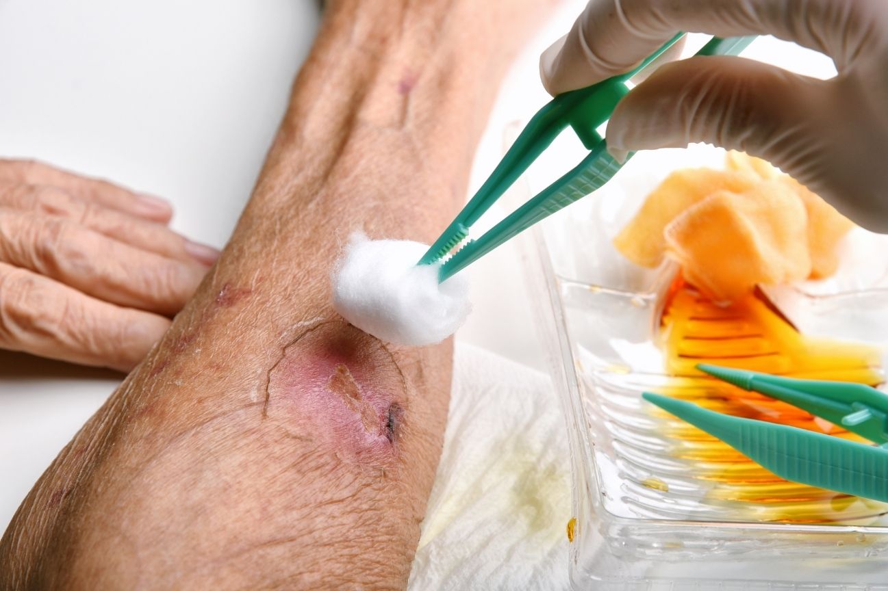 Professional wound care treatment - Advanced medical techniques and compassionate patient care